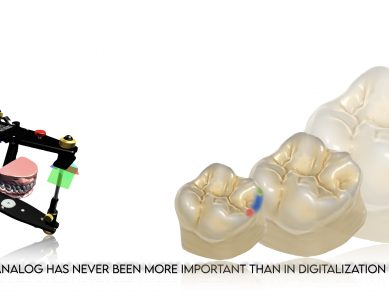 Part 4 – The Slavicek concept in digital dentistry