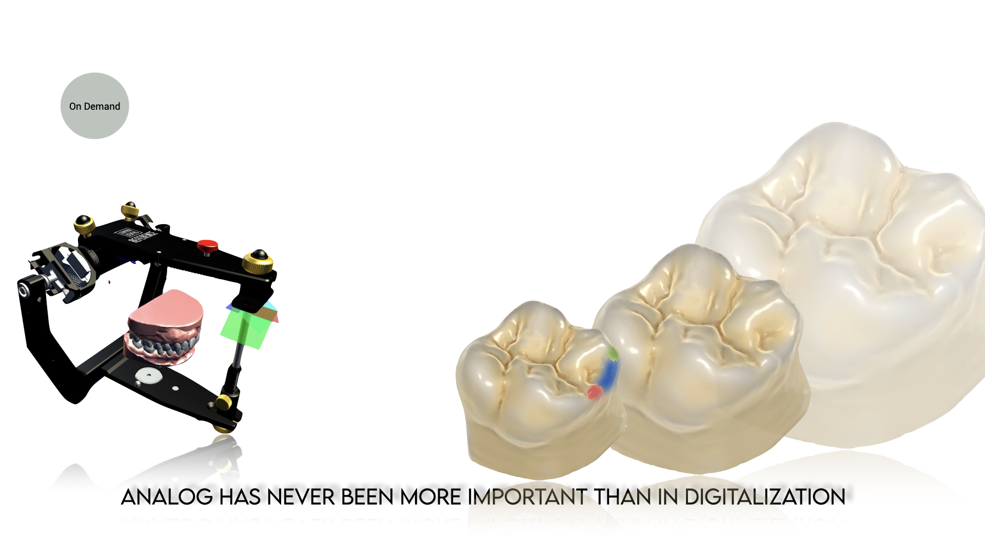 Part 4 – The Slavicek concept in digital dentistry