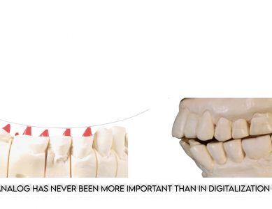 Part 3 – The “so-called” malocclusion